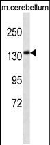 CAMSAP3 Antibody in Western Blot (WB)