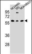 CLEC17A Antibody in Western Blot (WB)