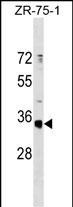 OR51G1 Antibody in Western Blot (WB)