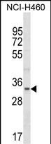 FBLL1 Antibody in Western Blot (WB)