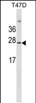 GKN3P Antibody in Western Blot (WB)