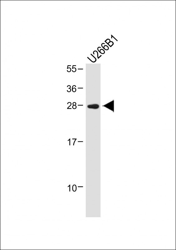 IGLL5 Antibody in Western Blot (WB)