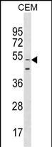 GOLGA6L9 Antibody in Western Blot (WB)
