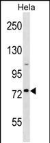GOLGA8H Antibody in Western Blot (WB)