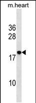 RNF24 Antibody in Western Blot (WB)