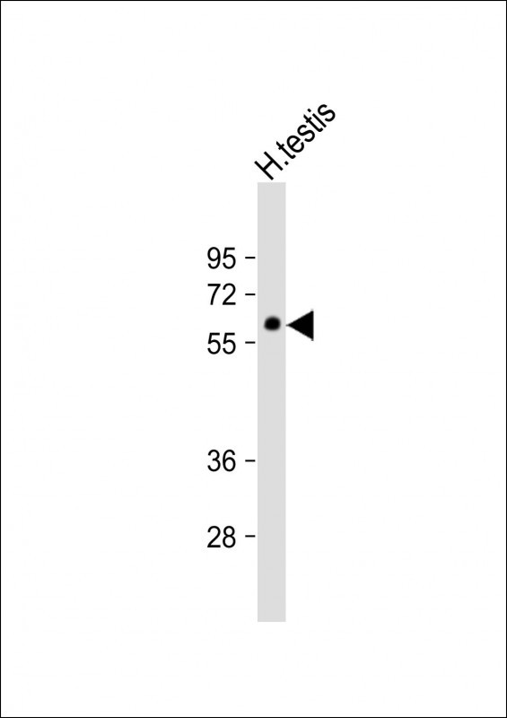 GMCL1L Antibody in Western Blot (WB)