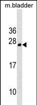 TPD52L1 Antibody in Western Blot (WB)
