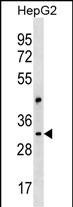 CEP170L Antibody in Western Blot (WB)