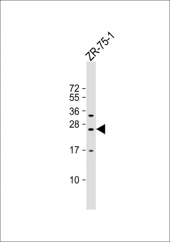 KLRF2 Antibody in Western Blot (WB)
