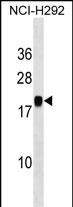 MIR7-3HG Antibody in Western Blot (WB)