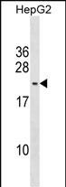 PMS2L5 Antibody in Western Blot (WB)
