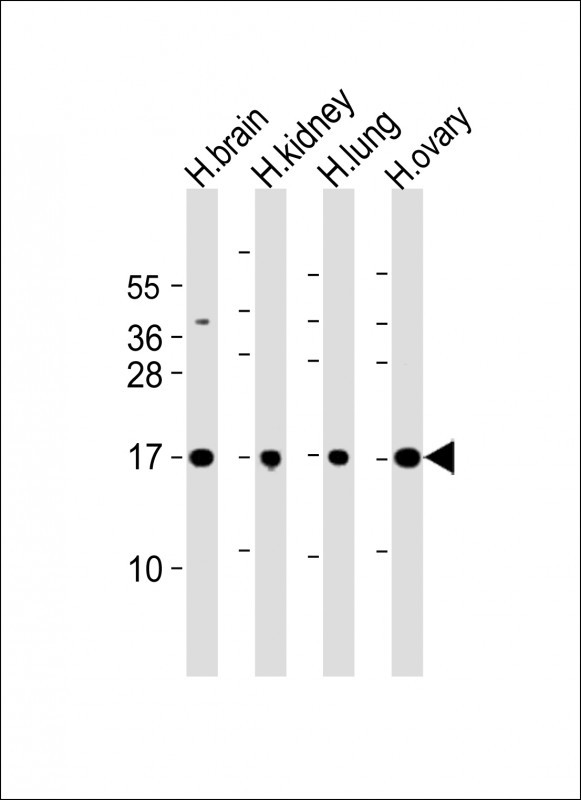 PPIAL4A Antibody in Western Blot (WB)