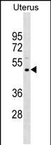 PRAMEF11 Antibody in Western Blot (WB)