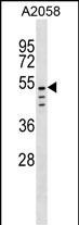 CLEC18C Antibody in Western Blot (WB)