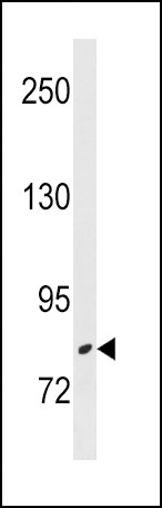 ZBTB17 Antibody in Western Blot (WB)