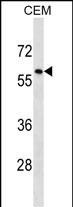 TRIM58 Antibody in Western Blot (WB)