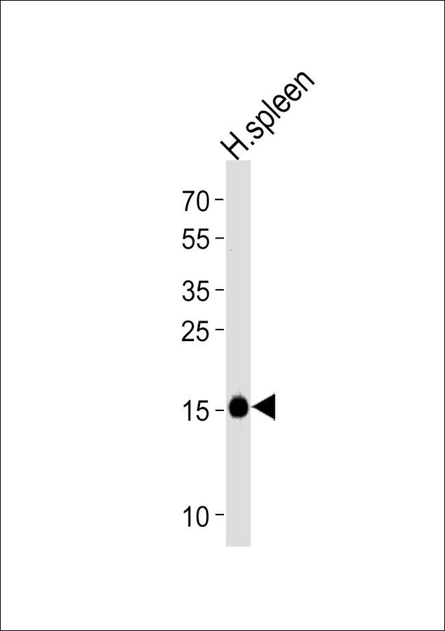 RNASE2 Antibody in Western Blot (WB)