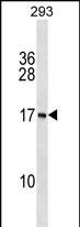 PAPPAS Antibody in Western Blot (WB)