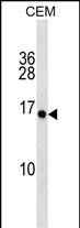 PLGLA Antibody in Western Blot (WB)