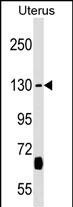 KIF27 Antibody in Western Blot (WB)