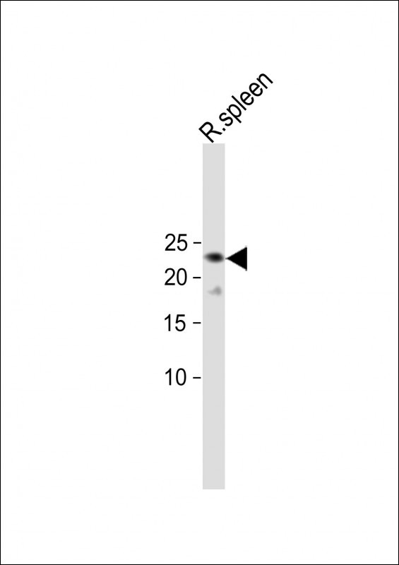TRGC2 Antibody in Western Blot (WB)
