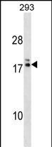 HIATL2 Antibody in Western Blot (WB)
