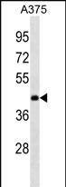 ANKRD63 Antibody in Western Blot (WB)