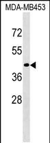 CD200R1L Antibody in Western Blot (WB)