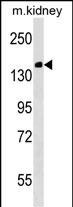 Casc5 Antibody in Western Blot (WB)