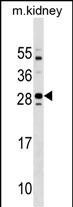 Tmem125 Antibody in Western Blot (WB)