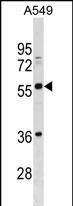 BTN2A3P Antibody in Western Blot (WB)