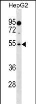 PRAMEF18 Antibody in Western Blot (WB)