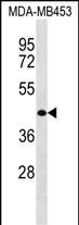 WASH2P Antibody in Western Blot (WB)