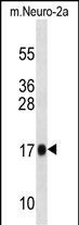 RPL13A Antibody in Western Blot (WB)