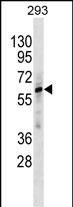 ZNF775 Antibody in Western Blot (WB)