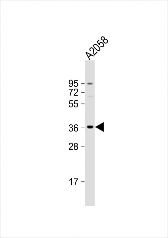 OR52J3 Antibody in Western Blot (WB)