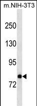 DAB2 Antibody in Western Blot (WB)