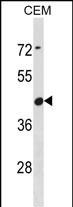 CBWD6 Antibody in Western Blot (WB)