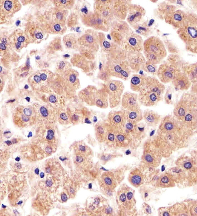 TFIP11 Antibody in Immunohistochemistry (Paraffin) (IHC (P))