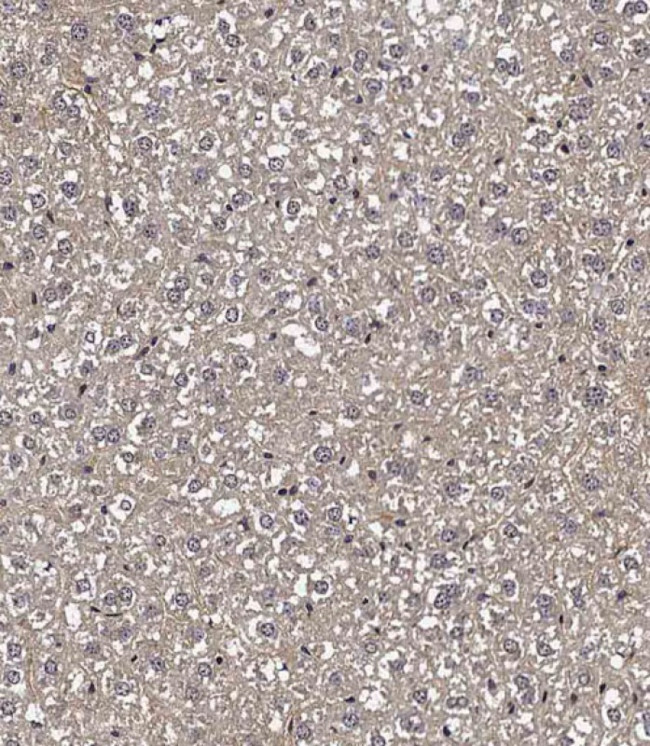 TXNIP Antibody in Immunohistochemistry (Paraffin) (IHC (P))