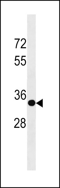 SPRY3 Antibody in Western Blot (WB)