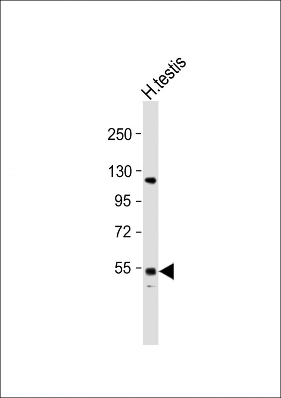 GOLGA6L2 Antibody in Western Blot (WB)