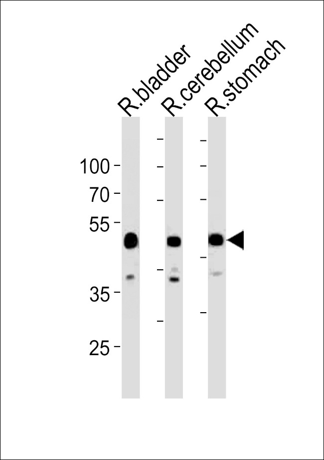 CBWD1 Antibody in Western Blot (WB)
