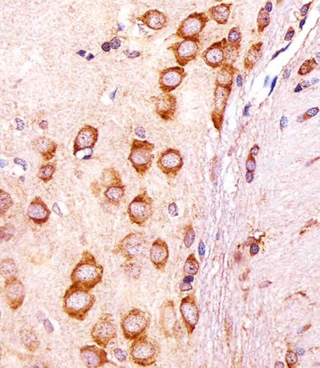 CGREF1 Antibody in Immunohistochemistry (Paraffin) (IHC (P))