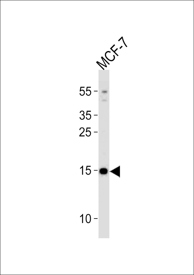 POLR2J3 Antibody in Western Blot (WB)
