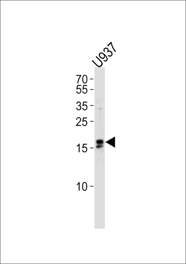 IQCF6 Antibody in Western Blot (WB)