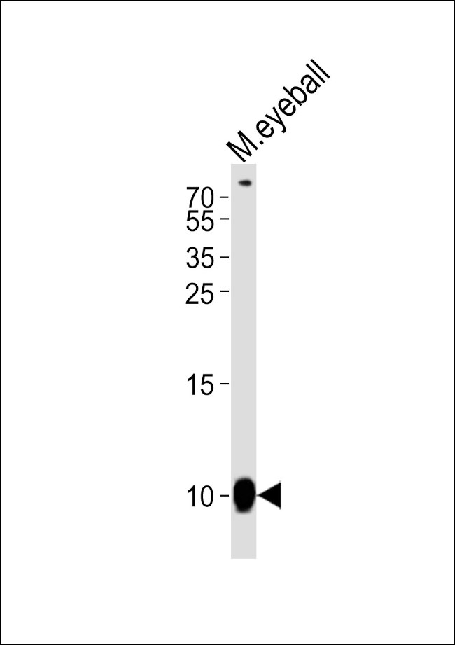 GNGT1 Antibody in Western Blot (WB)