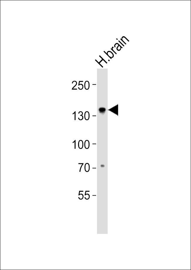OVOS1 Antibody in Western Blot (WB)
