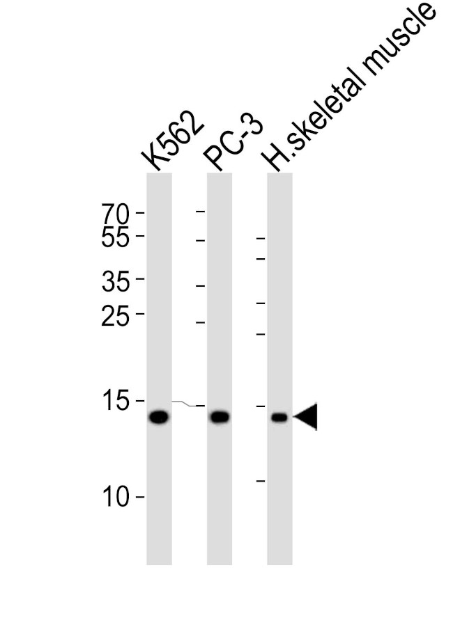 HIST1H2BM Antibody in Western Blot (WB)