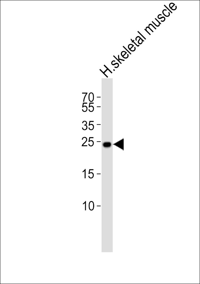 TMEM239 Antibody in Western Blot (WB)